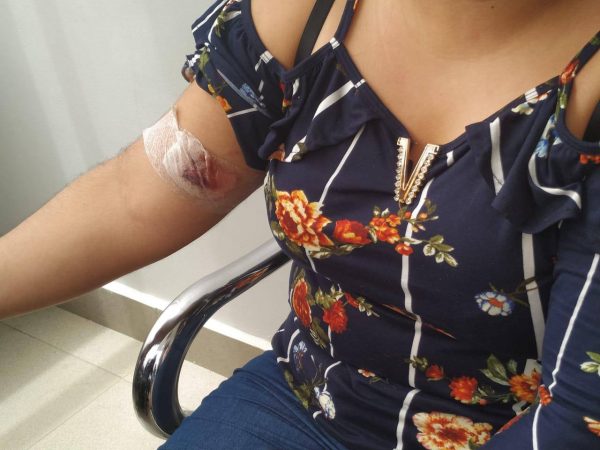 ATENCIÓN | Mujer Fue Herida Por Otra Durante Robo En Durán - Diario ...